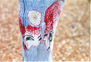 Pant leg.